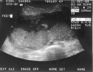 Babyfeet.jpg (31963 bytes)