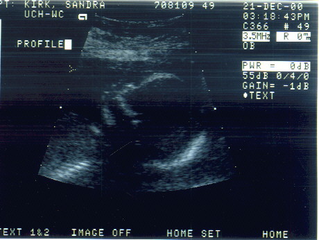 Babypro.jpg (51525 bytes)