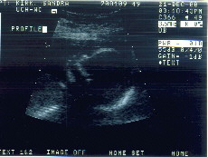 Babyus.jpg (16655 bytes)