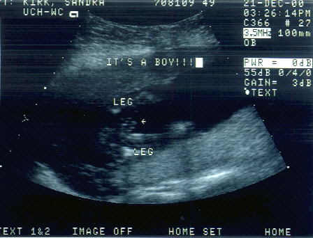 Itsaboy.jpg (54471 bytes)